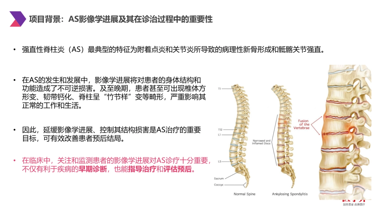 诺华可善挺AS共识巡讲&相关病例演讲项目_第2页