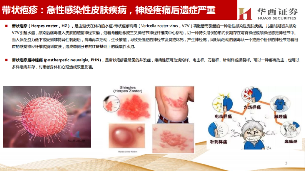 带状疱疹疫苗行业研究:老年人健康需求值得关注,市场潜力巨大_第4页