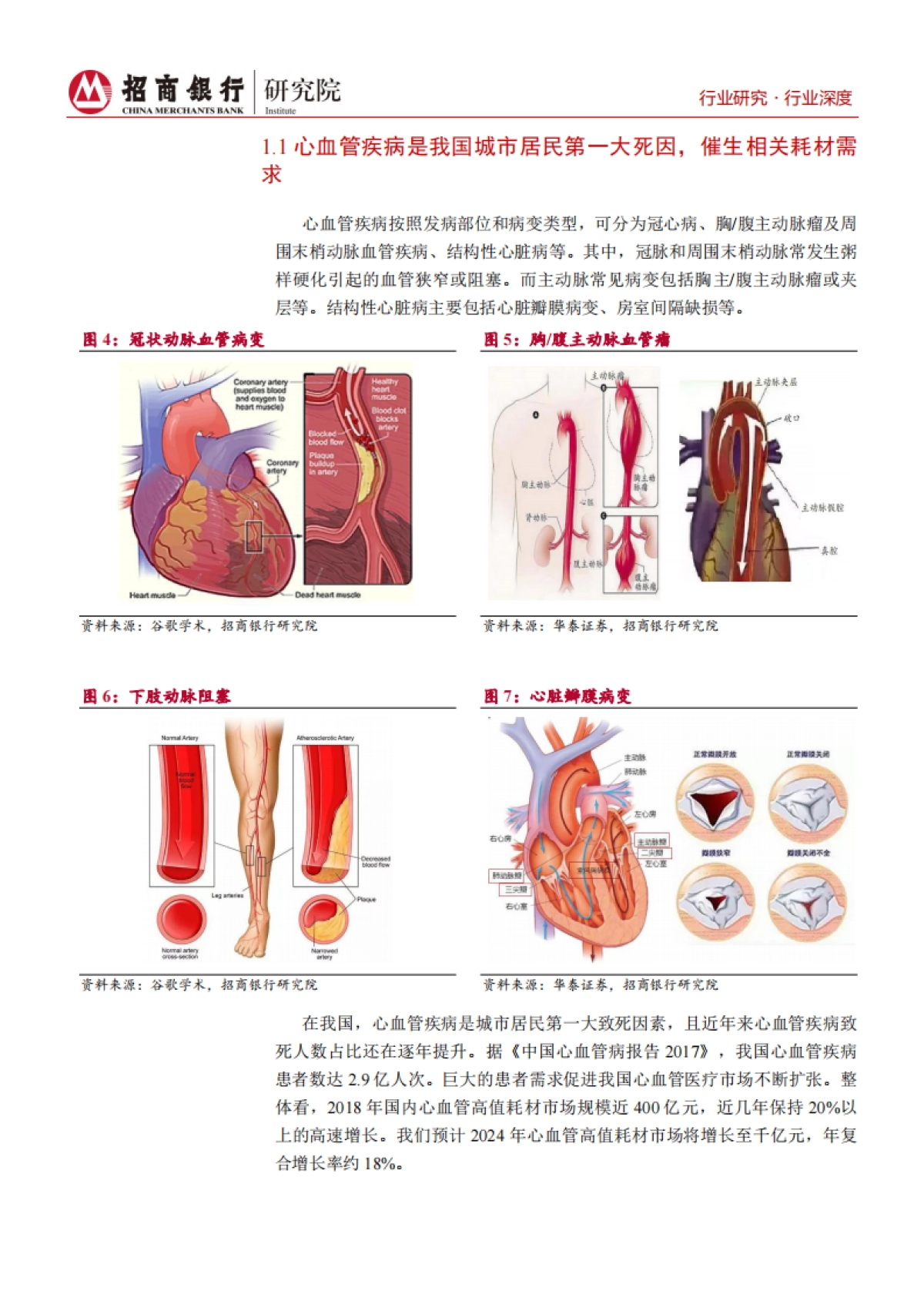 生物医药行业之心血管耗材篇：关注行业龙头扩张及创新企业增长_第6页