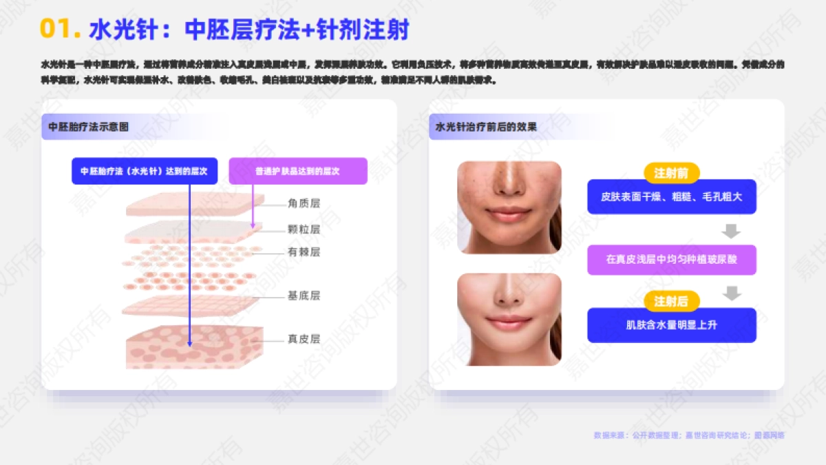 【嘉世咨询】2025医美水光针行业简析报告_第2页
