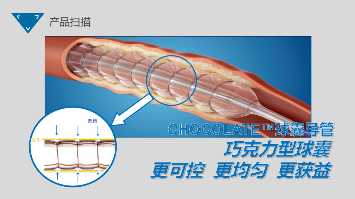 2019CHOCOLATE球囊导管上市活动创意方案_第4页